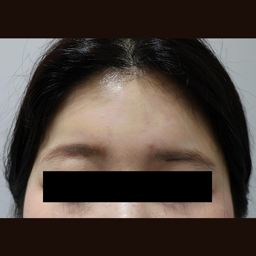 After