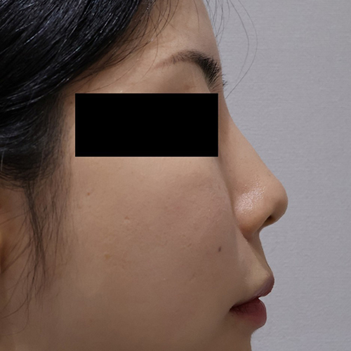 After