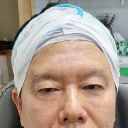 Before