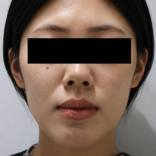 Before