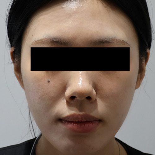After