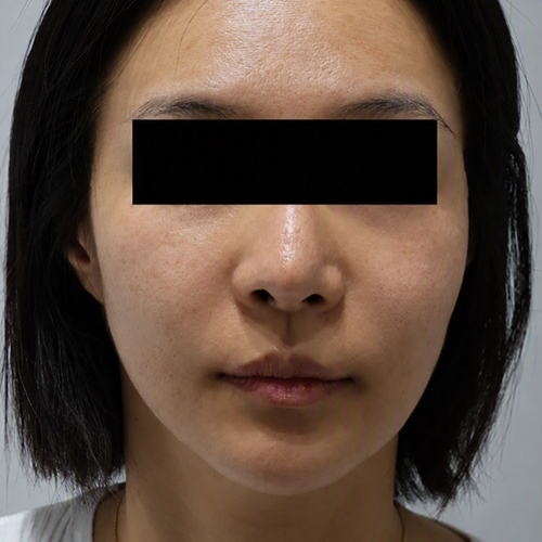 After