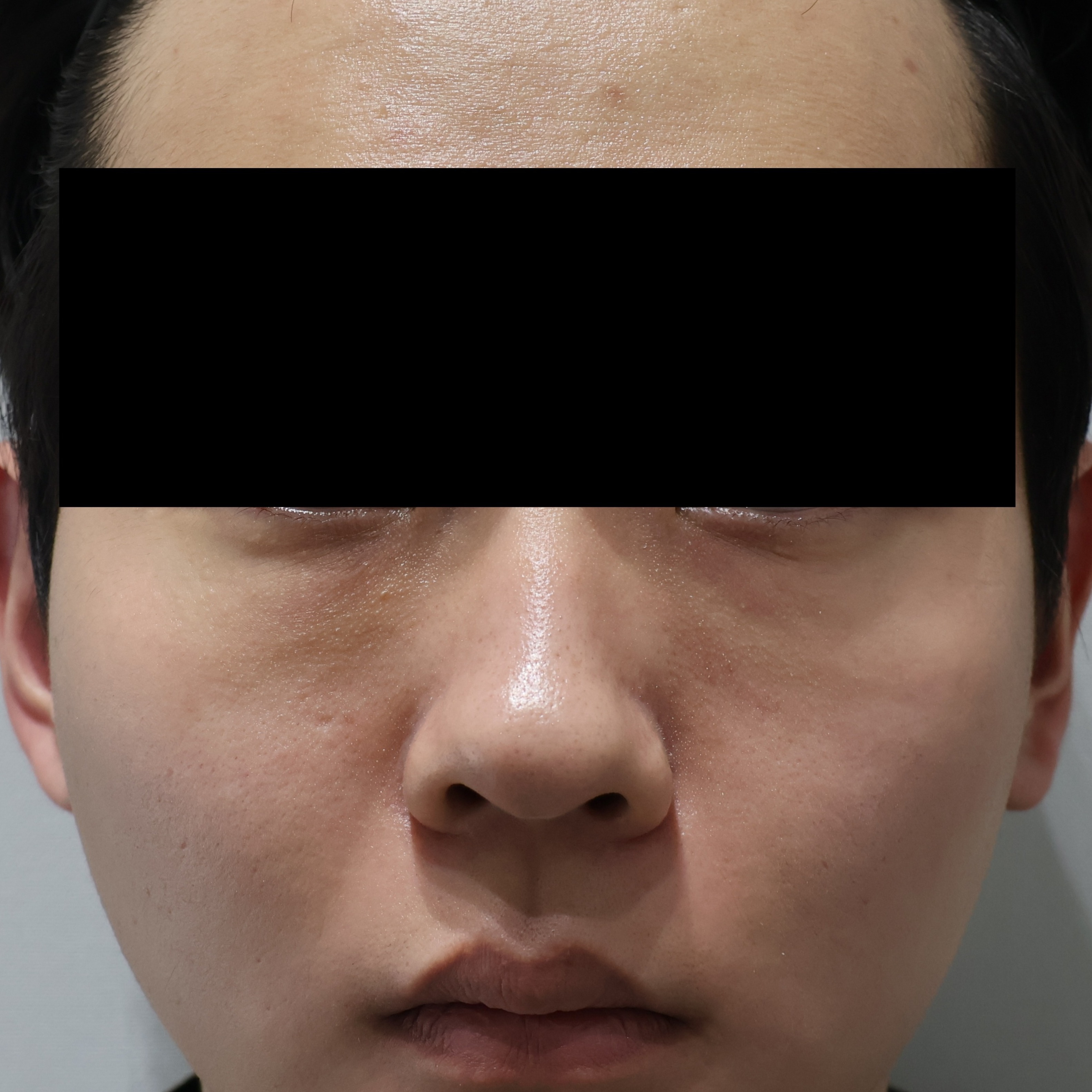 After